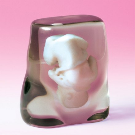 fetus1.jpg